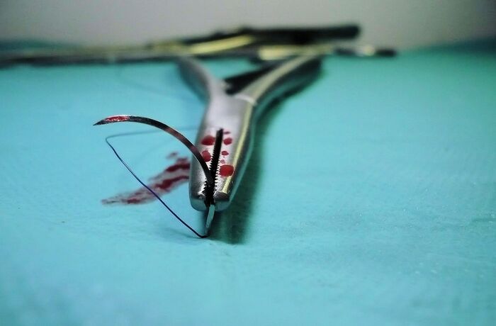 SPÖ-Gesundheitsreform in Kärnten ist gescheitert!